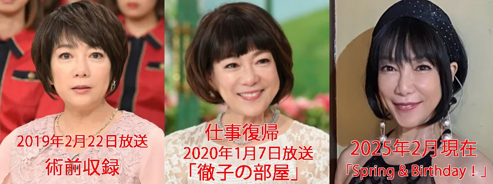 "堀ちえみさんの顔の印象の変化を時系列で比較した画像。左から、舌がん手術前、仕事復帰時の顔、現在の顔が並んでいる。"