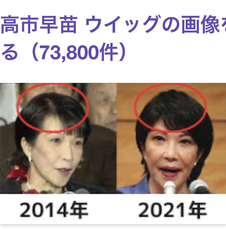 高市早苗さんの髪型が2014年と2021年で比較されている画像です。ウィッグや髪型の変化に関する記事で使われることが多いと考えられます。