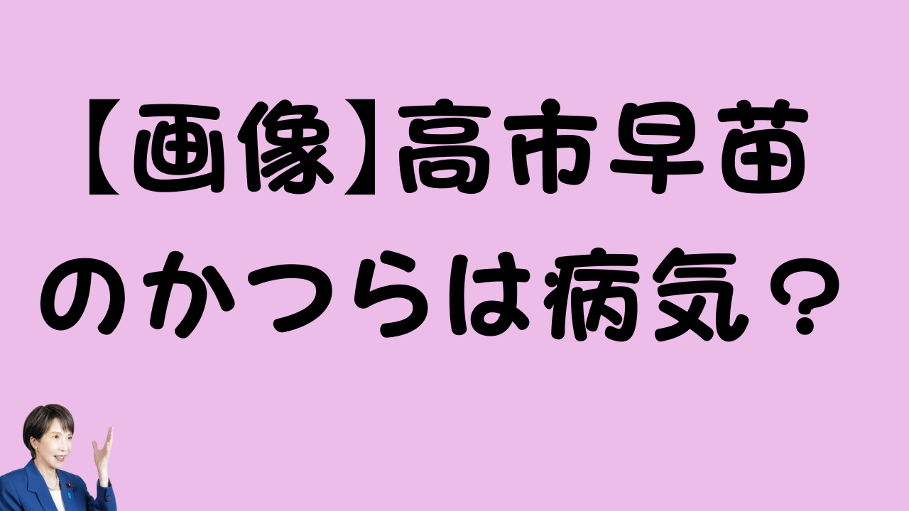 「【画像】高市早苗のかつらは病気？」というテキストと、手を挙げている高市早苗さんの小さな写真が含まれた、記事のアイキャッチ画像です。